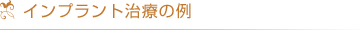 インプラント治療の例